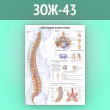 Плакат «Заболевания позвоночника» (ЗОЖ-43, ламинированная бумага, А2, 1 лист)